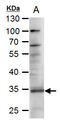 TNF Superfamily Member 11 antibody, GTX108515, GeneTex, Western Blot image 