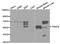 TNF Receptor Associated Factor 6 antibody, TA326872, Origene, Western Blot image 