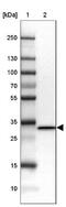 Ribosomal Protein S6 antibody, NBP1-87099, Novus Biologicals, Western Blot image 