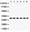 Cyclin Dependent Kinase 1 antibody, PB9533, Boster Biological Technology, Western Blot image 