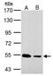 Small RNA Binding Exonuclease Protection Factor La antibody, GTX113555, GeneTex, Western Blot image 