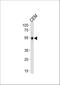 Kruppel Like Factor 5 antibody, A00727, Boster Biological Technology, Western Blot image 