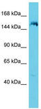 Ankyrin Repeat Domain 36B antibody, TA330708, Origene, Western Blot image 