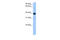 Serpin Family A Member 5 antibody, 30-877, ProSci, Western Blot image 