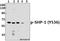 Protein Tyrosine Phosphatase Non-Receptor Type 6 antibody, A00938Y536, Boster Biological Technology, Western Blot image 