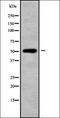Aldehyde Dehydrogenase 1 Family Member A3 antibody, orb337983, Biorbyt, Western Blot image 