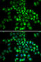 Polycomb Group Ring Finger 6 antibody, STJ28327, St John