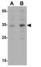 Apolipoprotein E antibody, GTX17206, GeneTex, Western Blot image 