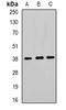 Torsin Family 1 Member A antibody, orb340818, Biorbyt, Western Blot image 