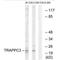 Trafficking Protein Particle Complex 3 antibody, A10070, Boster Biological Technology, Western Blot image 