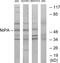 Zinc Finger C3HC-Type Containing 1 antibody, LS-B9866, Lifespan Biosciences, Western Blot image 