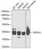 Selenophosphate Synthetase 1 antibody, GTX55789, GeneTex, Western Blot image 