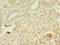 Alpha-2-Glycoprotein 1, Zinc-Binding antibody, LS-C377203, Lifespan Biosciences, Immunohistochemistry paraffin image 