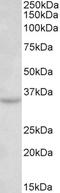 Tetraspanin 5 antibody, EB11778, Everest Biotech, Western Blot image 