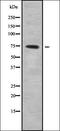 Calcium Modulating Ligand antibody, orb338093, Biorbyt, Western Blot image 