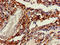 Cadherin 11 antibody, LS-C677461, Lifespan Biosciences, Immunohistochemistry paraffin image 