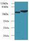 Fc Receptor Like 4 antibody, A59118-100, Epigentek, Western Blot image 