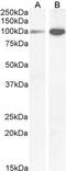 Glutamate Ionotropic Receptor NMDA Type Subunit 1 antibody, GTX89302, GeneTex, Western Blot image 