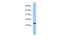 Parathyroid Hormone 2 antibody, GTX45547, GeneTex, Western Blot image 