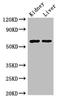Aldehyde Dehydrogenase 6 Family Member A1 antibody, LS-C498374, Lifespan Biosciences, Western Blot image 