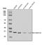 BRCA1/BRCA2-Containing Complex Subunit 3 antibody, A04690-1, Boster Biological Technology, Western Blot image 