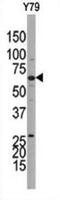 Guanylate Cyclase 1 Soluble Subunit Beta 1 antibody, abx033928, Abbexa, Western Blot image 