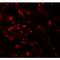 Carcinoembryonic Antigen Related Cell Adhesion Molecule 5 antibody, LS-C201121, Lifespan Biosciences, Immunofluorescence image 