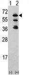 ACK1 antibody, AP17079PU-N, Origene, Western Blot image 