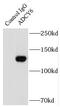 Adenylate Cyclase 6 antibody, FNab00157, FineTest, Immunoprecipitation image 