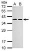 Ribosomal Protein Lateral Stalk Subunit P0 antibody, GTX114730, GeneTex, Western Blot image 