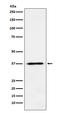 COP9 Signalosome Subunit 5 antibody, M01849, Boster Biological Technology, Western Blot image 