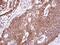 Endothelin Receptor Type B antibody, PA5-34636, Invitrogen Antibodies, Immunohistochemistry paraffin image 