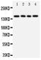 TN-R antibody, PA5-80172, Invitrogen Antibodies, Western Blot image 