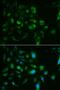 Toll Like Receptor 8 antibody, LS-C331494, Lifespan Biosciences, Immunofluorescence image 