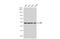 Dihydrolipoamide Branched Chain Transacylase E2 antibody, GTX113412, GeneTex, Western Blot image 