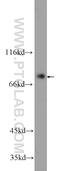 Zinc Finger And BTB Domain Containing 48 antibody, 24665-1-AP, Proteintech Group, Western Blot image 