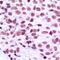 Myeloid Zinc Finger 1 antibody, orb214755, Biorbyt, Immunohistochemistry paraffin image 