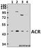 ACRS antibody, A02546, Boster Biological Technology, Western Blot image 