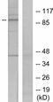 Signal Transducer And Activator Of Transcription 5A antibody, ab30648, Abcam, Western Blot image 