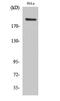 PHD Finger Protein 3 antibody, PA5-51037, Invitrogen Antibodies, Western Blot image 