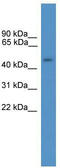 General Transcription Factor IIA Subunit 1 Like antibody, TA335368, Origene, Western Blot image 