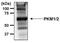 Pyruvate Kinase M1/2 antibody, MA5-14815, Invitrogen Antibodies, Immunoprecipitation image 