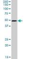Proteasome 26S Subunit, Non-ATPase 6 antibody, H00009861-D01P, Novus Biologicals, Western Blot image 