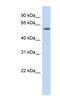 PiggyBac Transposable Element Derived 3 antibody, NBP1-57117, Novus Biologicals, Western Blot image 