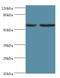 Diacylglycerol Kinase Epsilon antibody, MBS1499179, MyBioSource, Western Blot image 