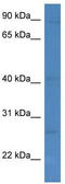 KLRC1 antibody, TA343145, Origene, Western Blot image 