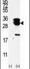 Ubiquitin Conjugating Enzyme E2 S antibody, PA5-11972, Invitrogen Antibodies, Western Blot image 