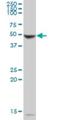 Phenylalanine Hydroxylase antibody, H00005053-B01P, Novus Biologicals, Western Blot image 