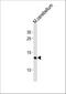 Eukaryotic Translation Initiation Factor 1 antibody, M04125, Boster Biological Technology, Western Blot image 