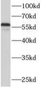 Acyl-CoA Synthetase Family Member 2 antibody, FNab00105, FineTest, Western Blot image 